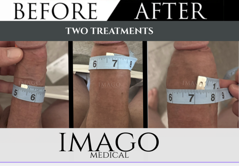 Medical Male Enhancement