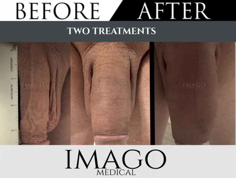 Medical Male Enhancement